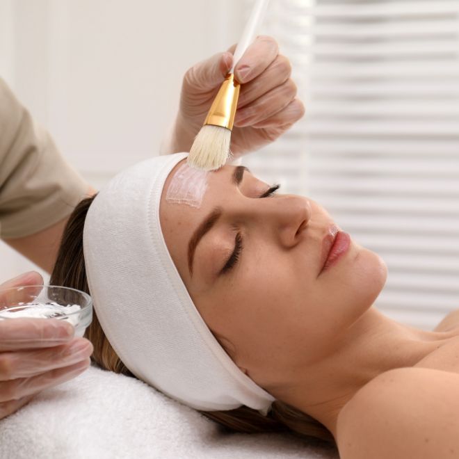 Chemical Peels Service